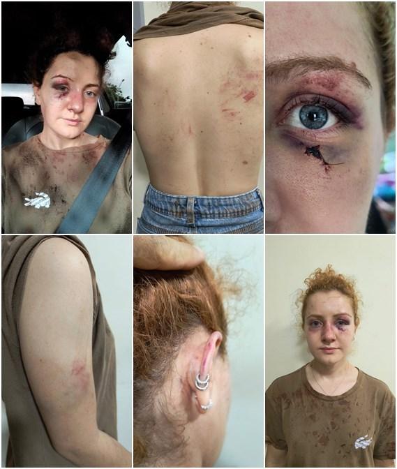 Fisioterapeuta agredida cobra justiça em Igaporã.